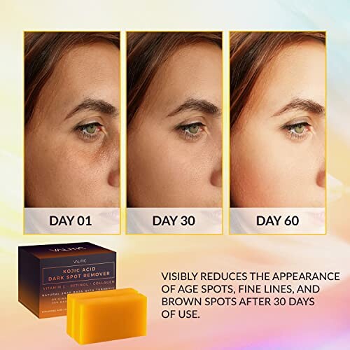 Before and after images showing effects of Kojic Acid Dark Spot Remover over 60 days with product packaging.