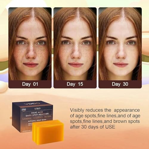 Three images showing a woman's skin improvement over 30 days with a soap bar.